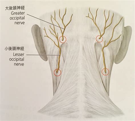 後頭痛原因